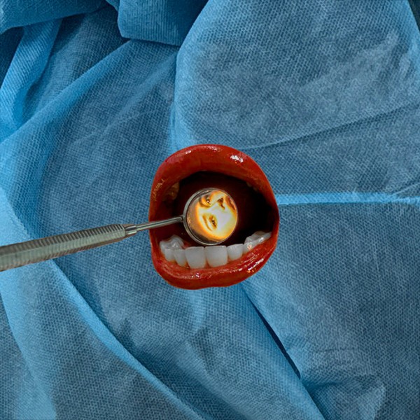 all up in your mouth (like a dentist)